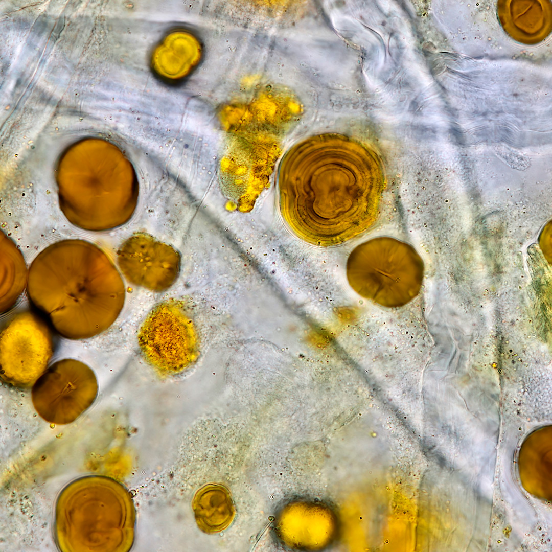 Identificación de Cristales en el Sedimento Urinario 1 Identificación de Cristales en el Sedimento Urinario