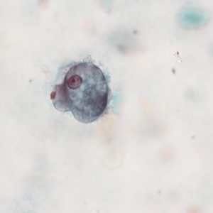 Diagnóstico parasitológico de Protozoos Intestinales