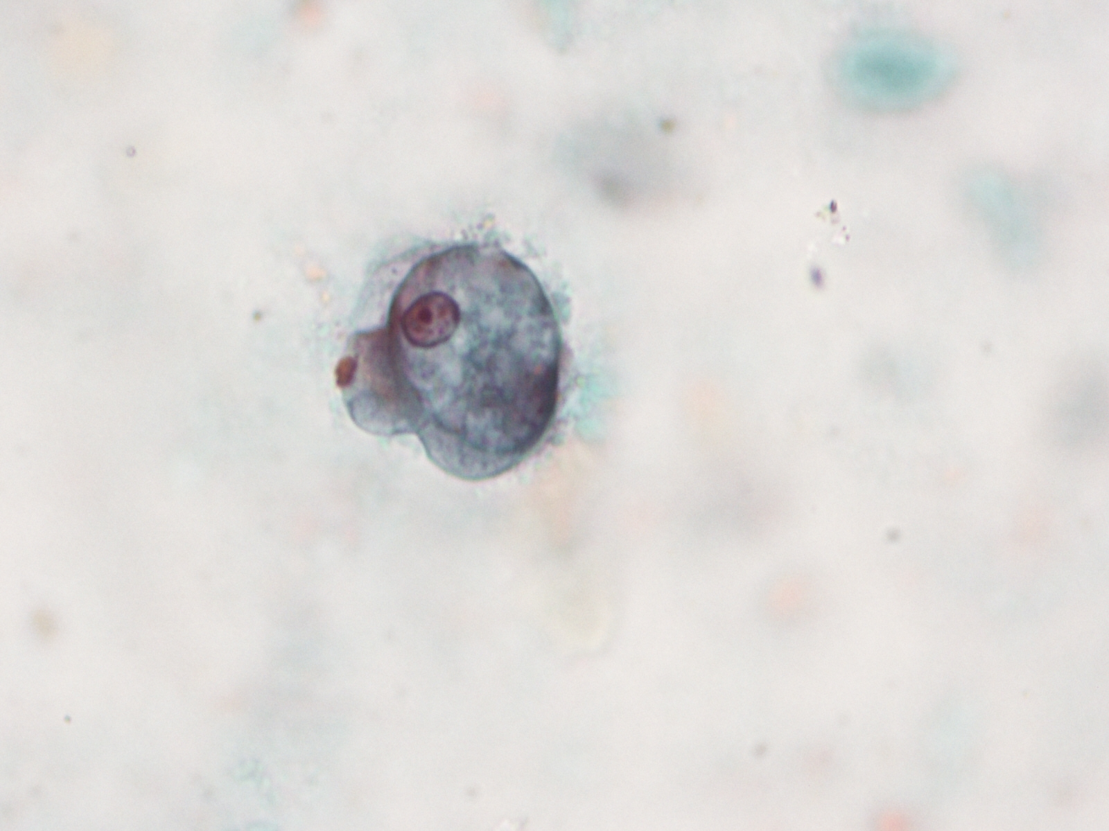 Diagnóstico parasitológico de Protozoos Intestinales 1 Diagnóstico parasitológico de Protozoos Intestinales