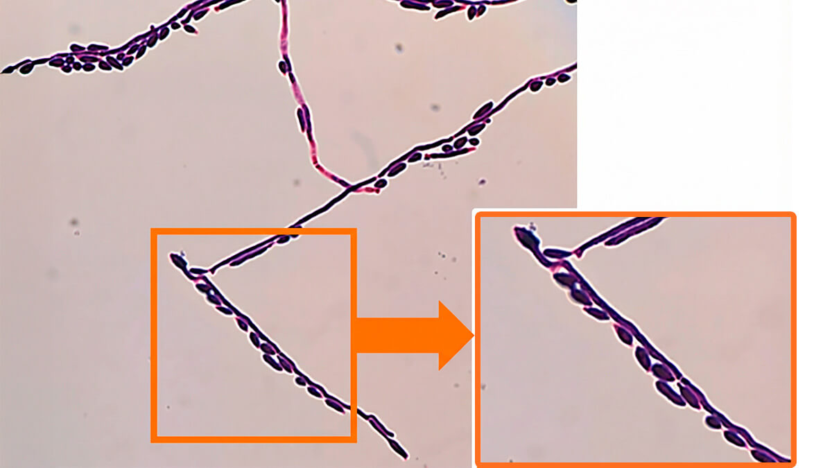 Gram de Candida allociferrii