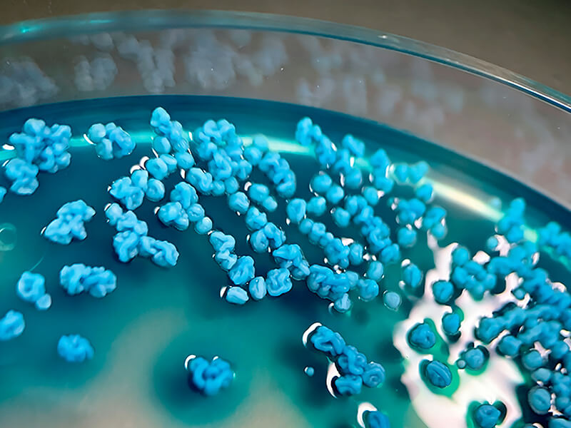 Colonias de Candida allociferrii en CHROMagar Candida Plus